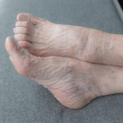 elderly feet